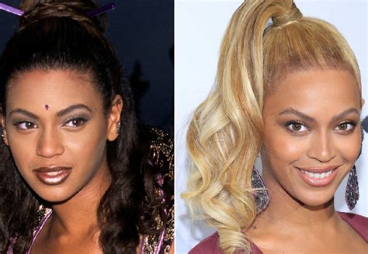 Beyonc&eacute; Knowles Plastic Surgery Before and After