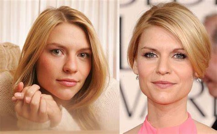 Claire Danes Plastic Surgery Before and After