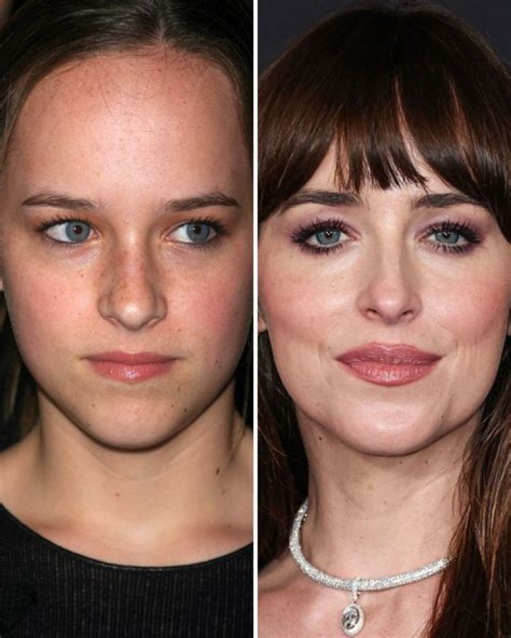 Dakota Johnson Plastic Surgery Before and After
