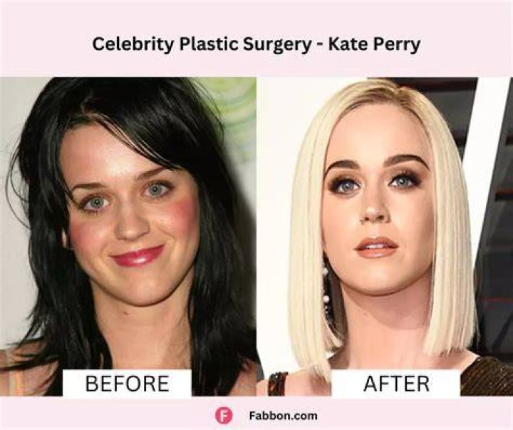 Hugh Grant Plastic Surgery Before and After