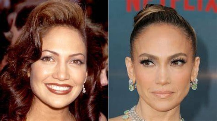 Jennifer Lopez Plastic Surgery: Has She Done Any Plastic Surgery?