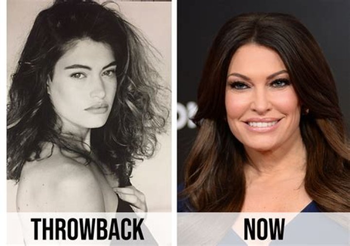 Unveiling The Truth: Did Kimberly Guilfoyle Have Plastic Surgery?